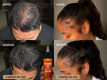 Aceite de Batana – Recupera tu cabello